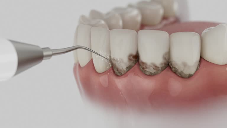 Trusted Tooth Extraction service in Villas, FL - Dentist Open Now